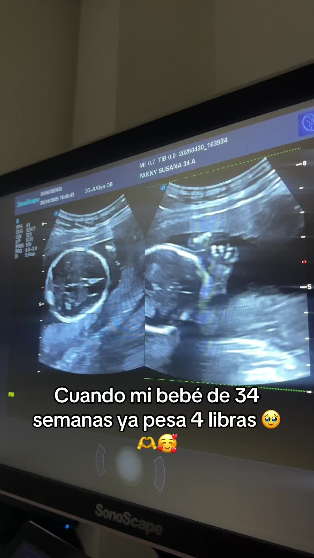 @Fanny