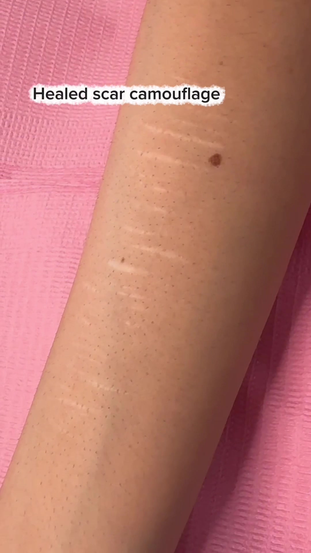 @Invisibleskinhelp