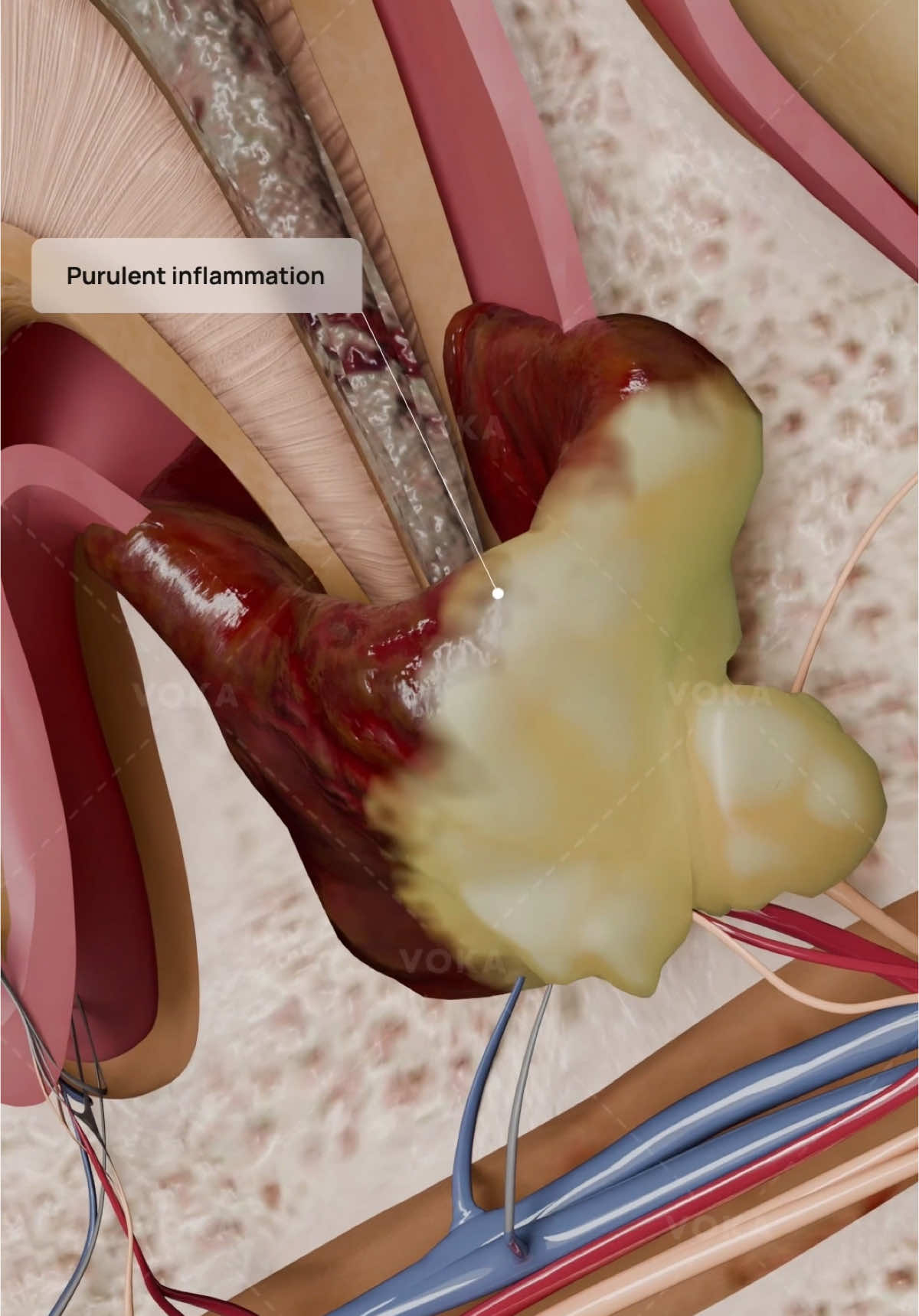 @VOKA 3D Anatomy & Pathology