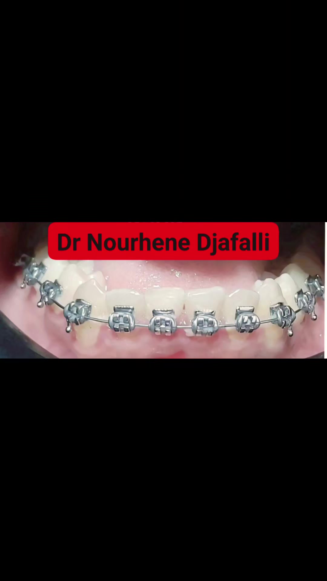 @Dr Nourhene Djaffali
