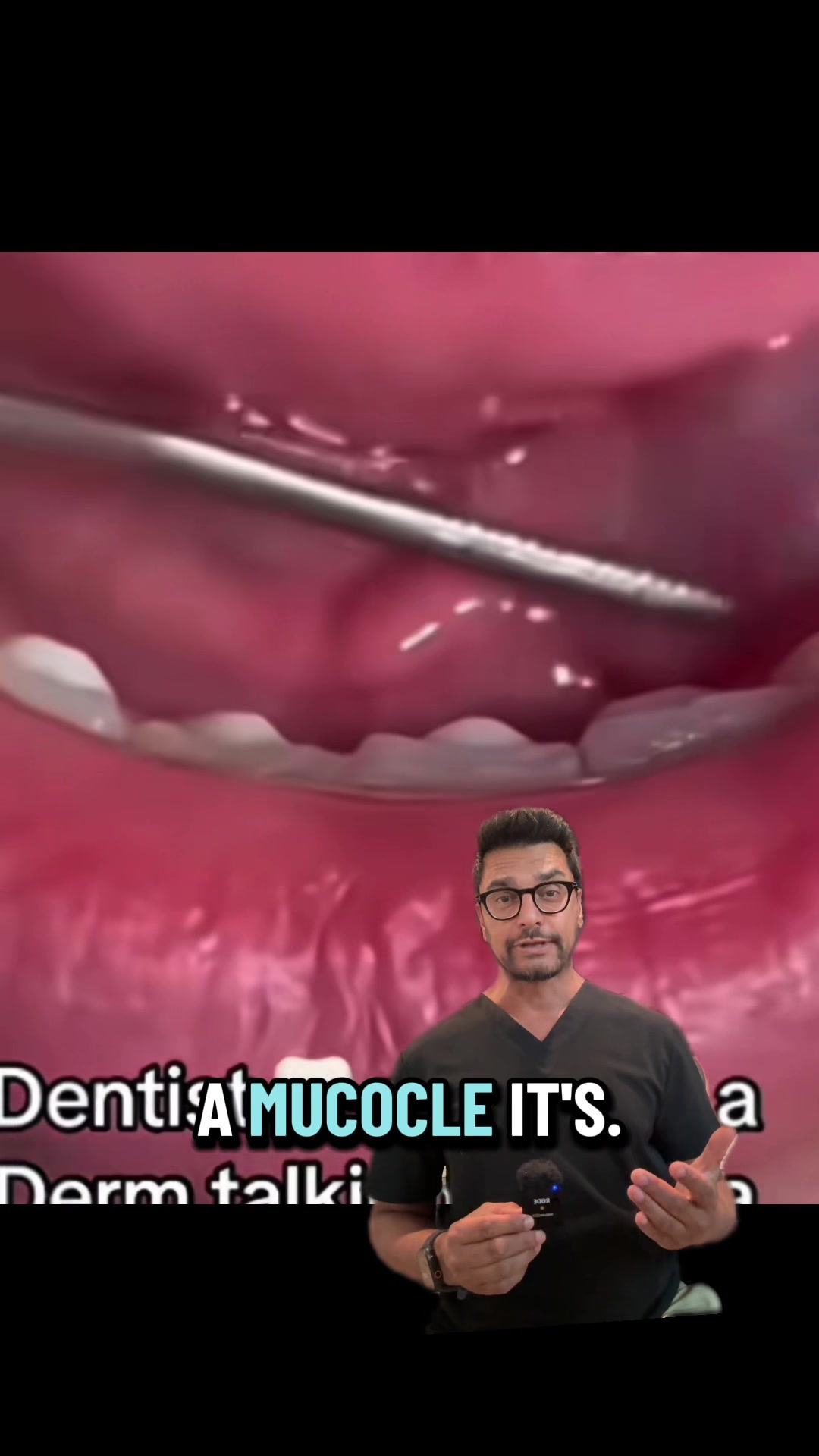 @Dentite