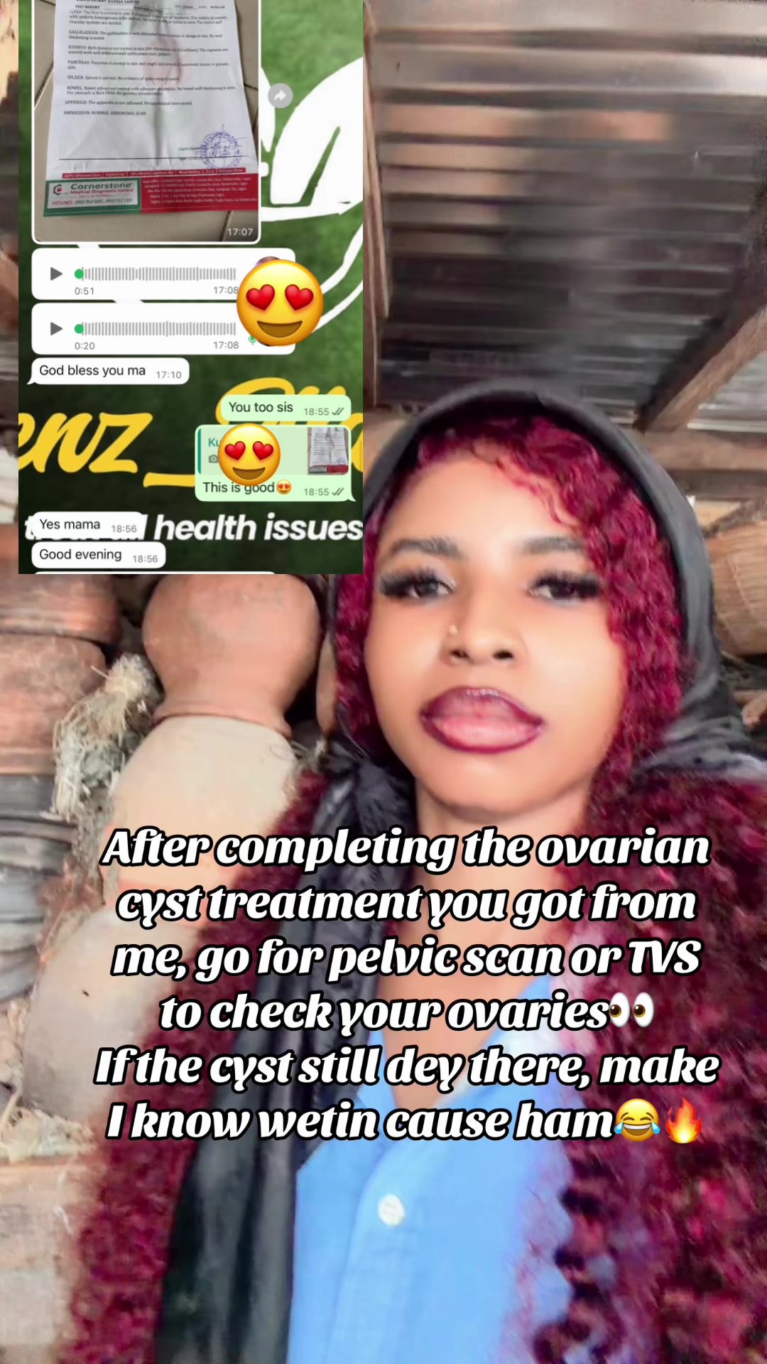@GeNz_alagbo🐍🍯