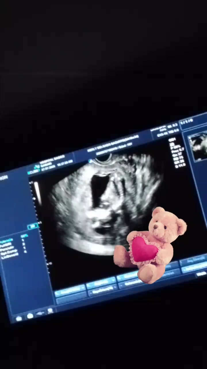 @๐๐๐ ๐ก๐๐ ๐๐๐๐ โ ๐โฃ๏ธ