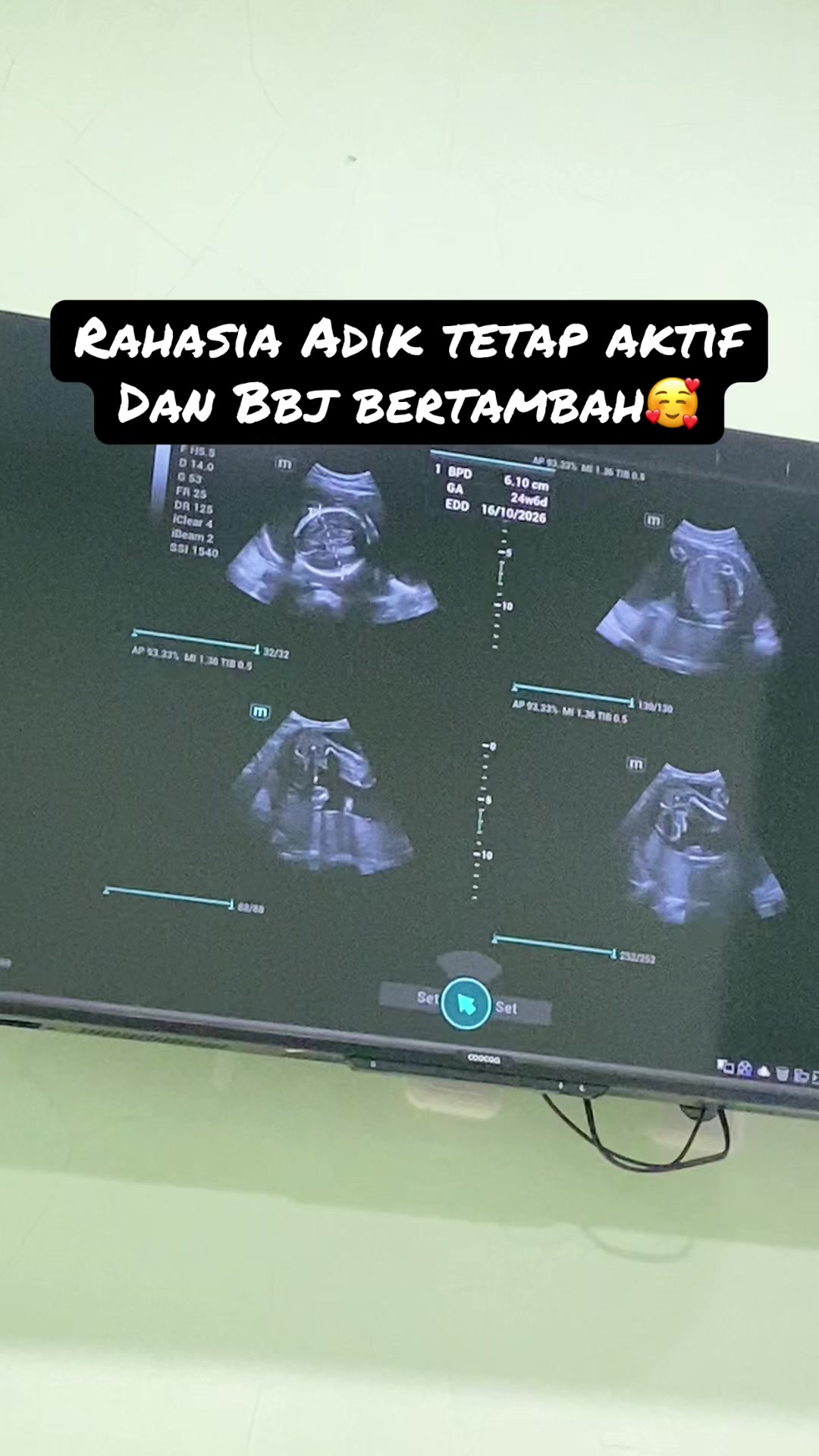 @Mommycantik