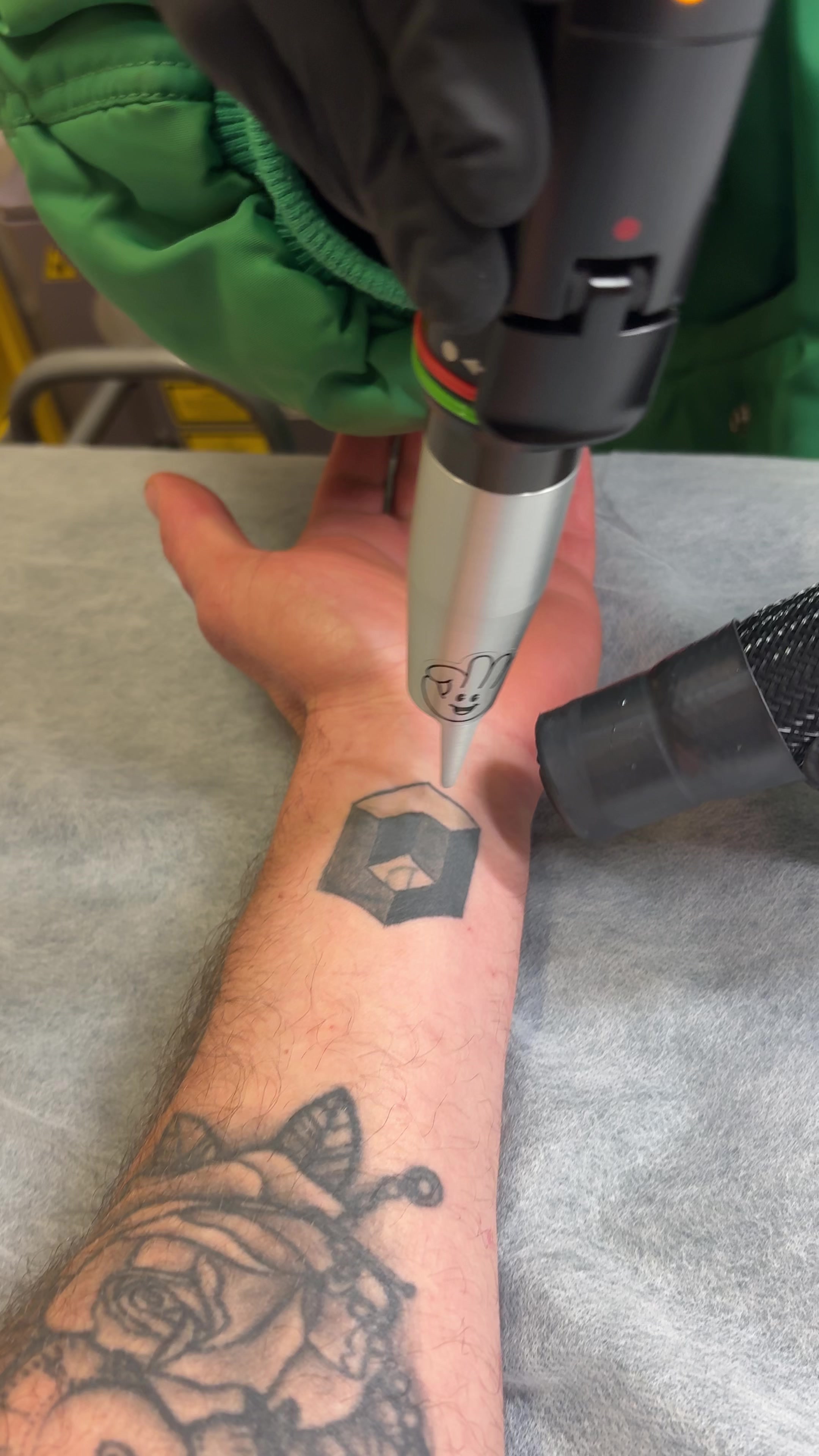@Swift_tattoo_removal