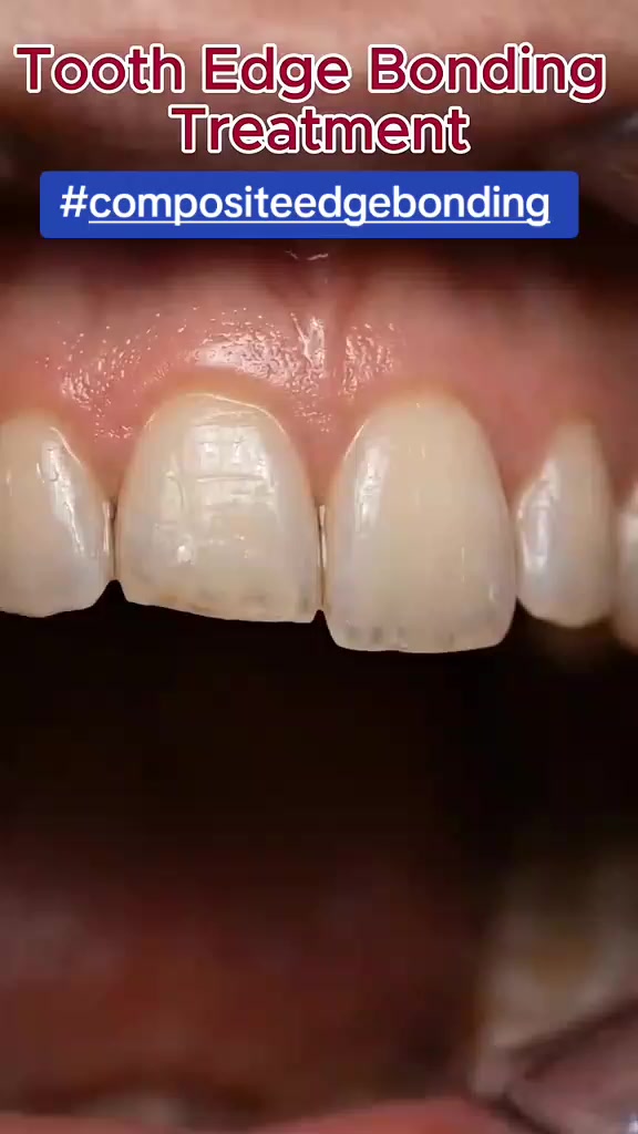 @MIRAHN DENTAL CARE