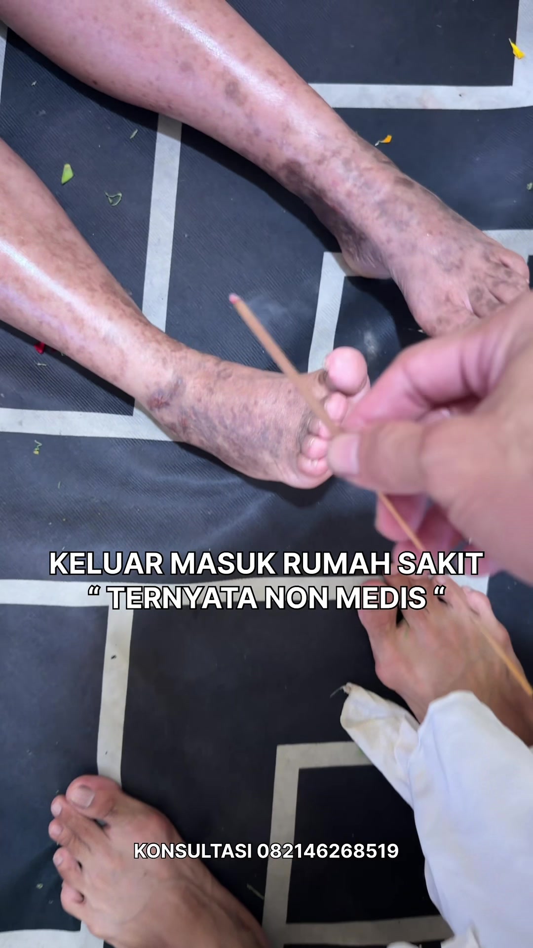 @Bayu Ivanders