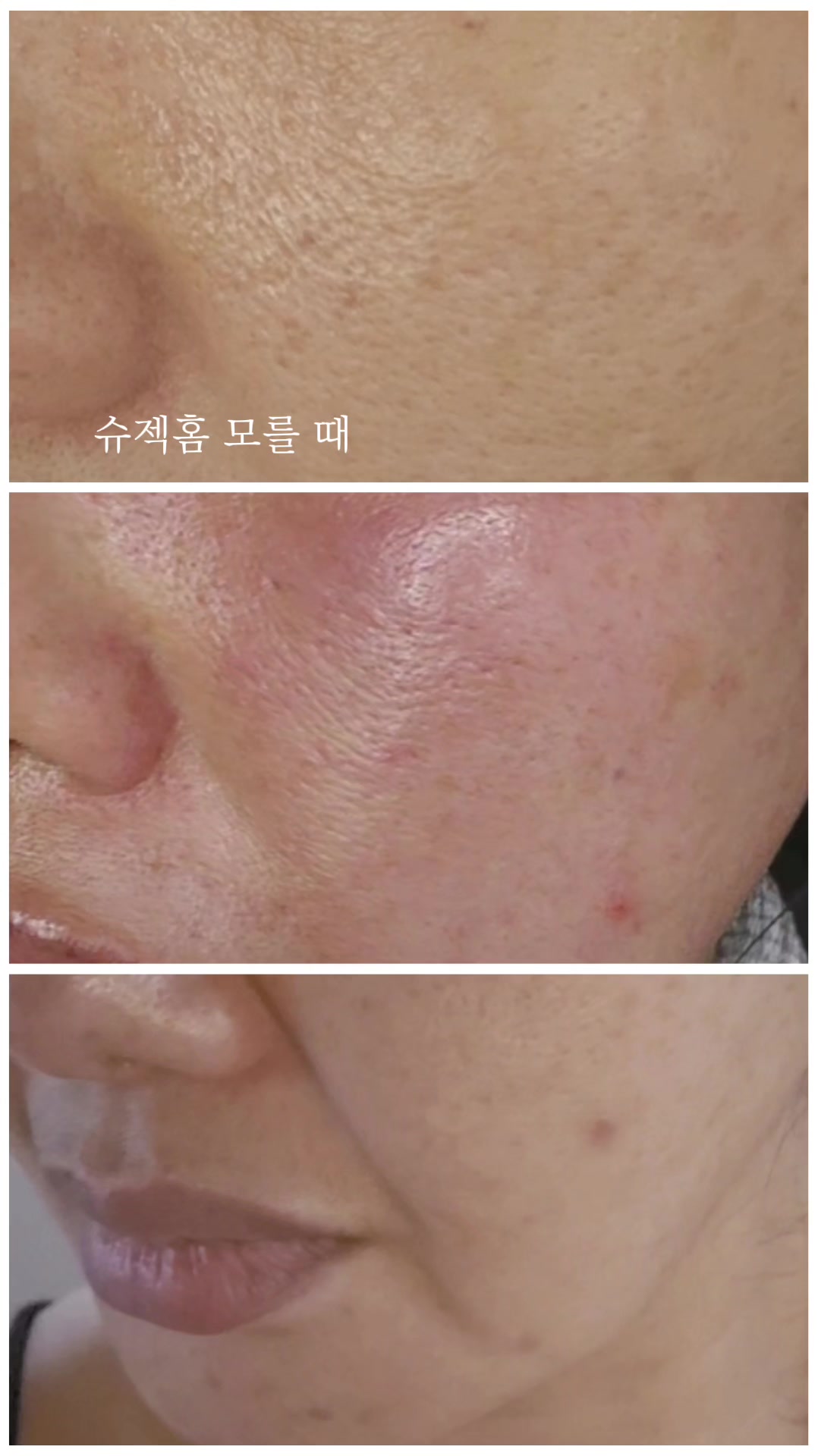 @피부굿당 박보살의 피부로 인생역전!