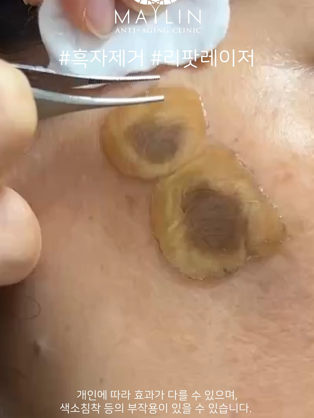 @메이린의원대구점