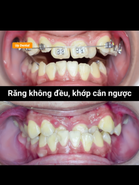 @Nha khoa niềng răng Up Dental
