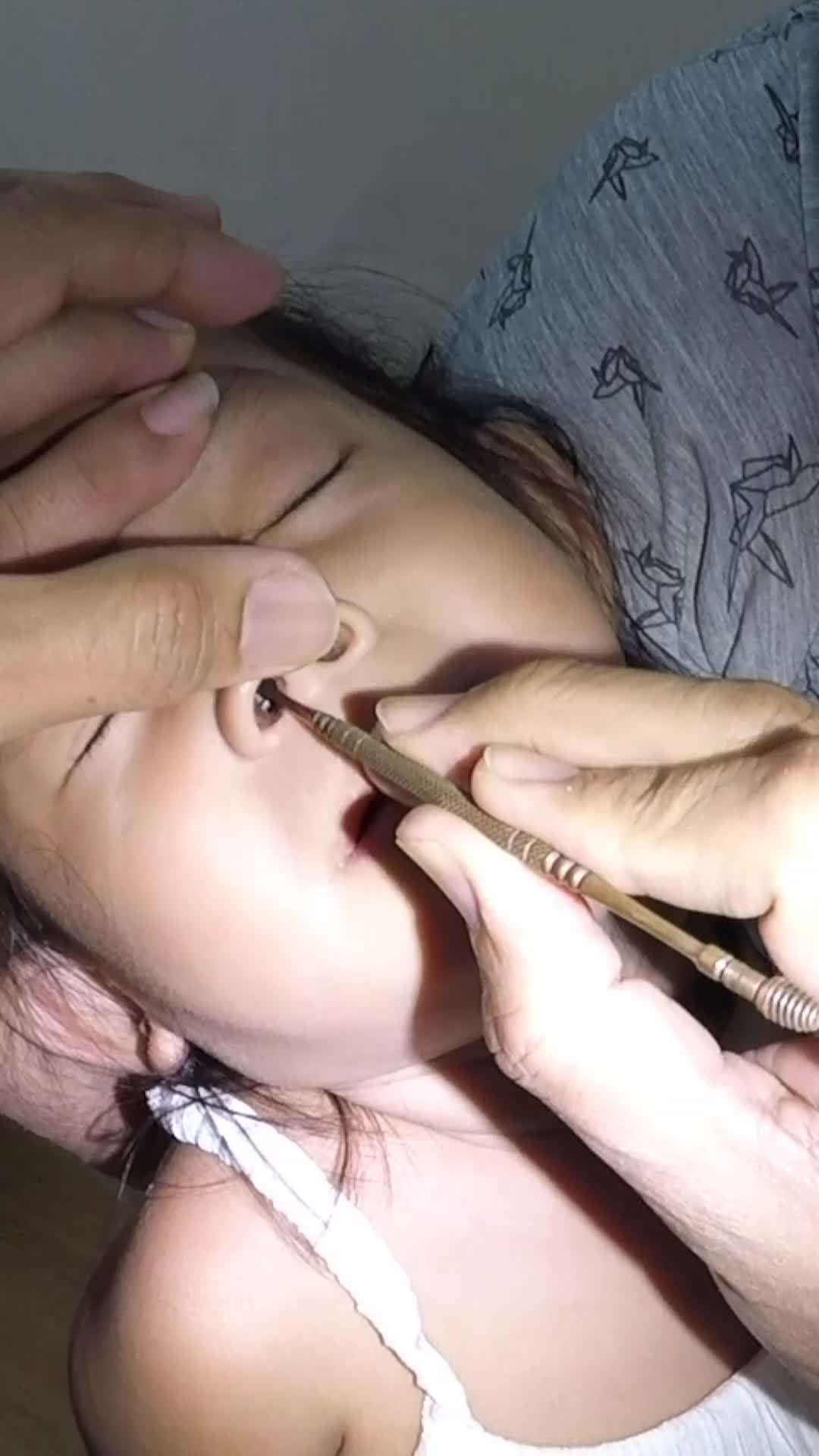@TheEarwaxSpecialist