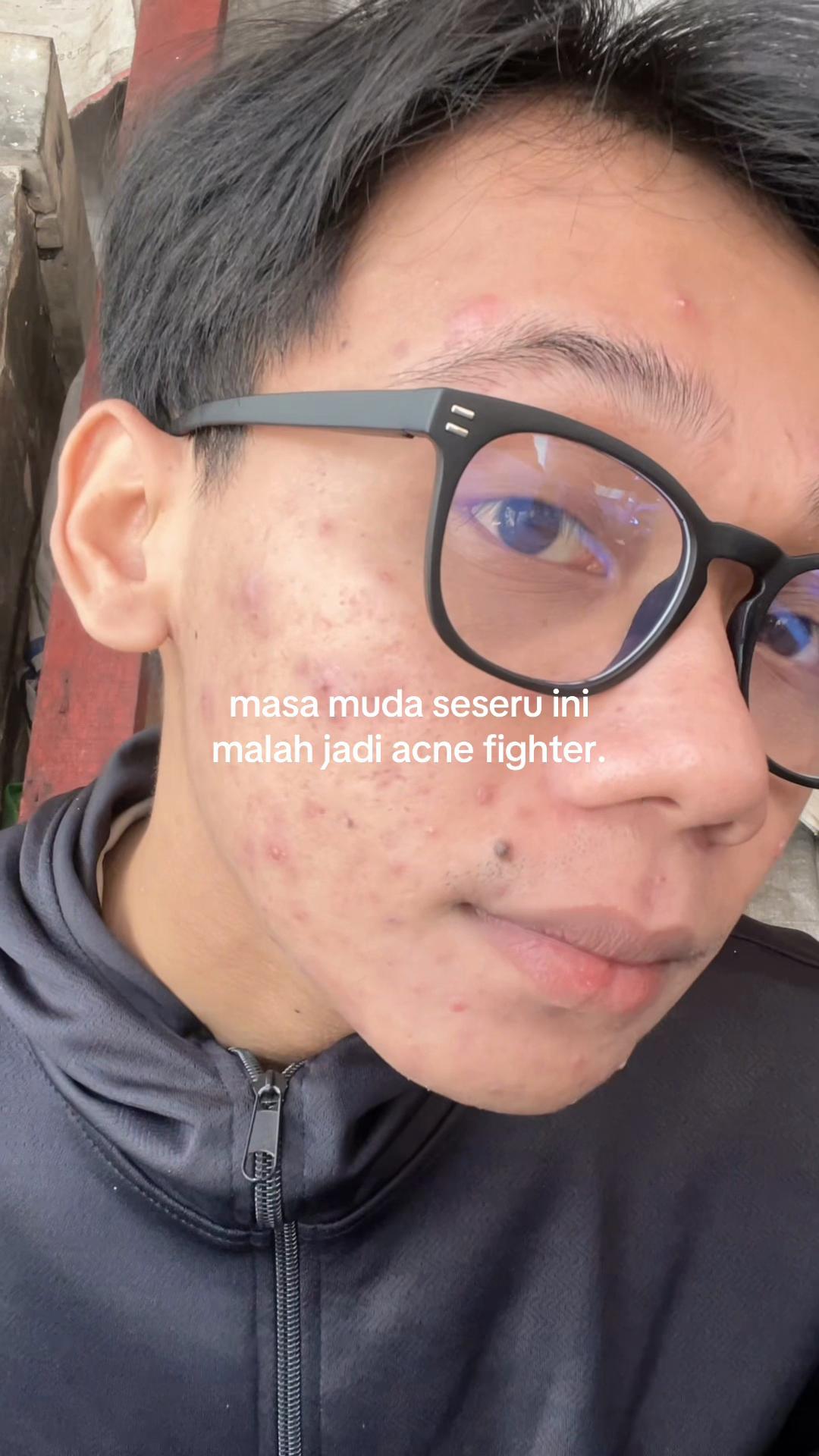 @๐๐ฃ—๐จ๐ฃ