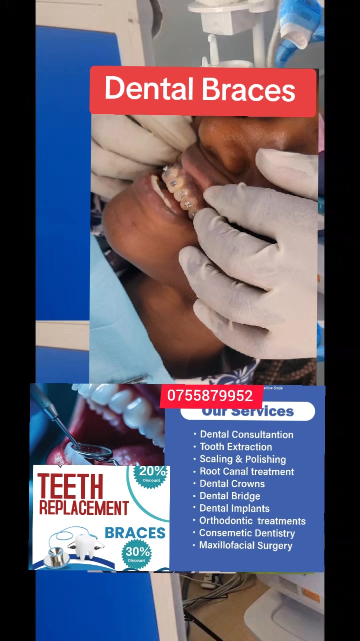 @Allianz Dental studio🦷🦷🇺🇬