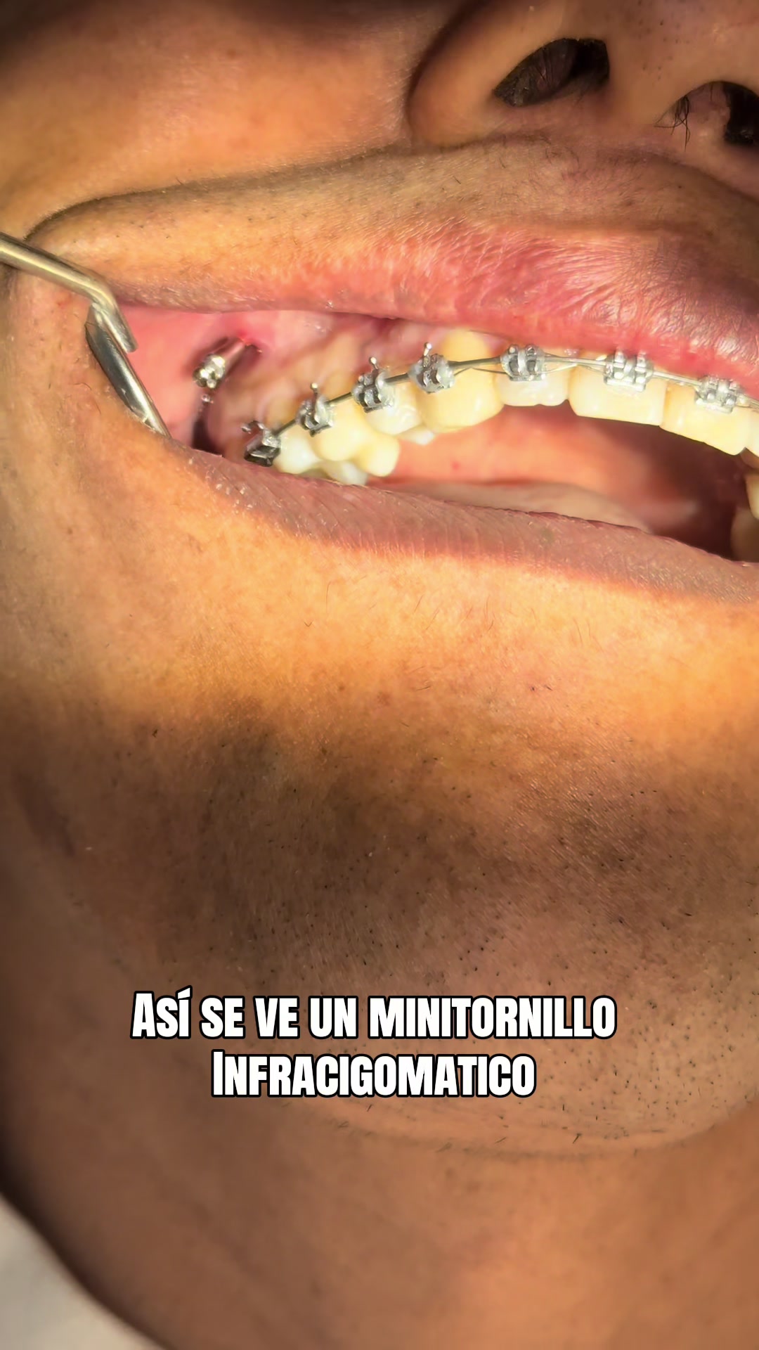 @Dr. Juan Perez | Ortodoncista