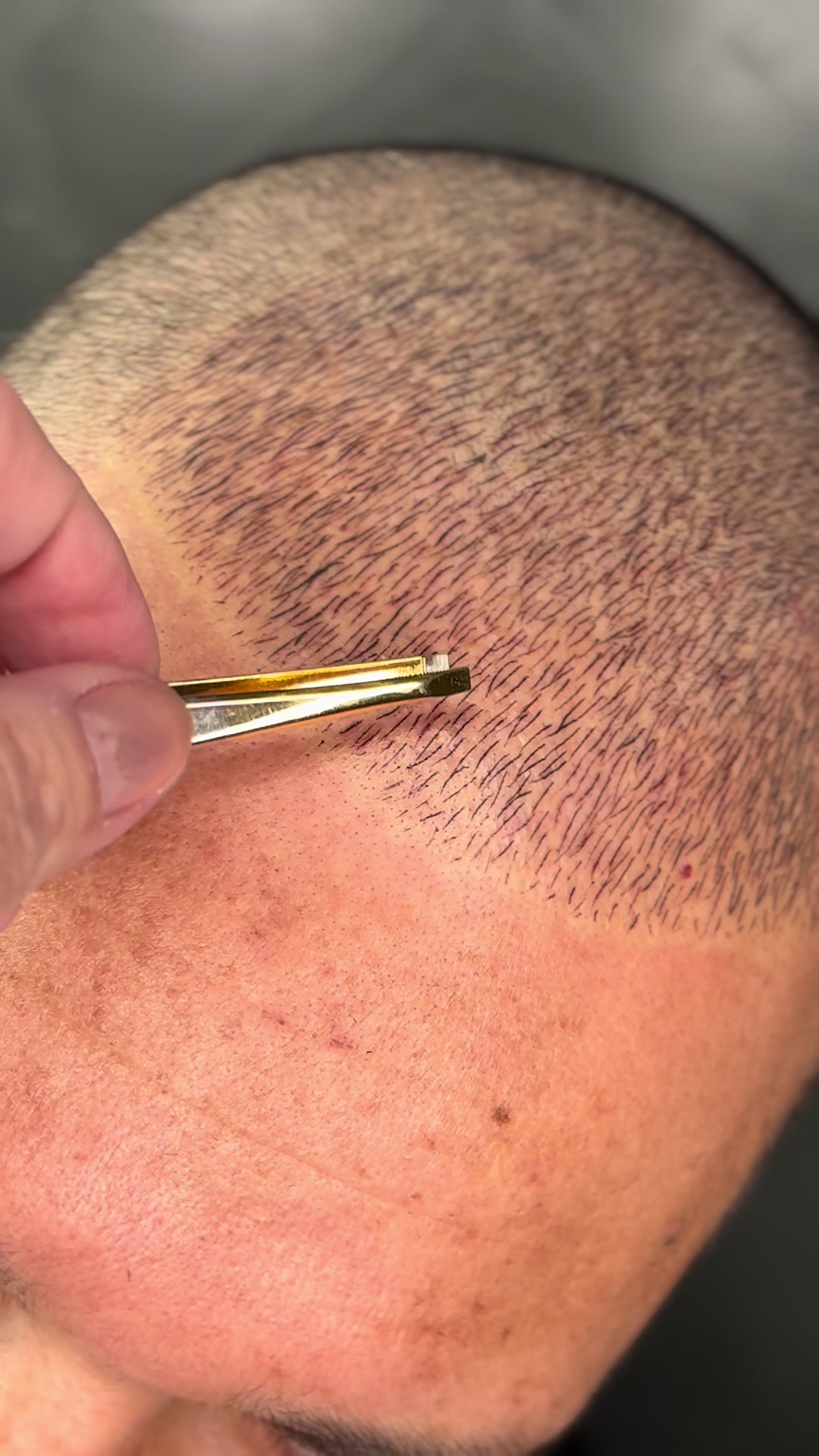 @Valesca Abi Ackel Scalp