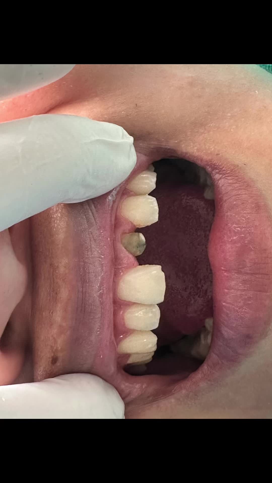 @vaidurya_dental_clinic