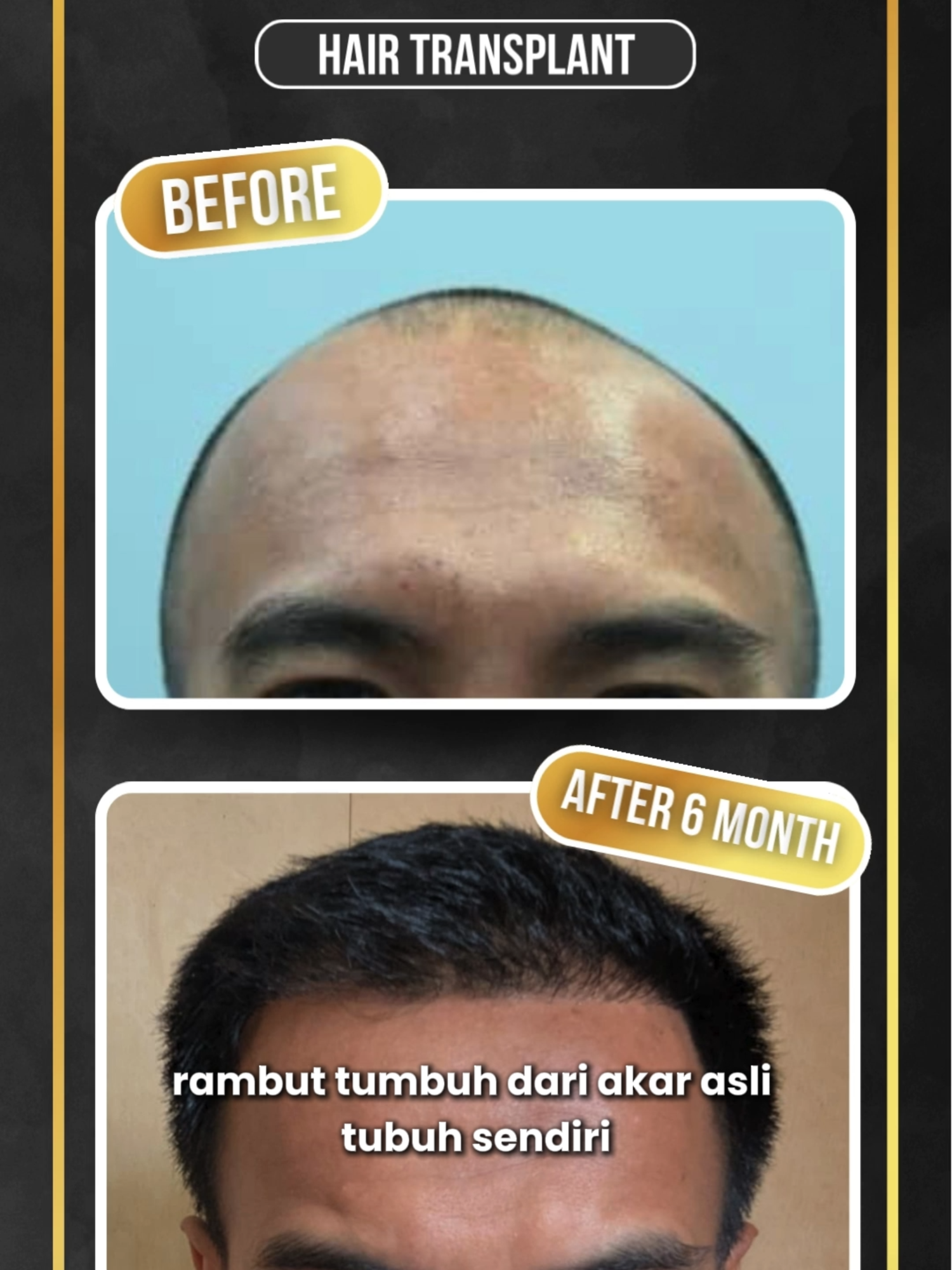 @Jakarta Men Clinic