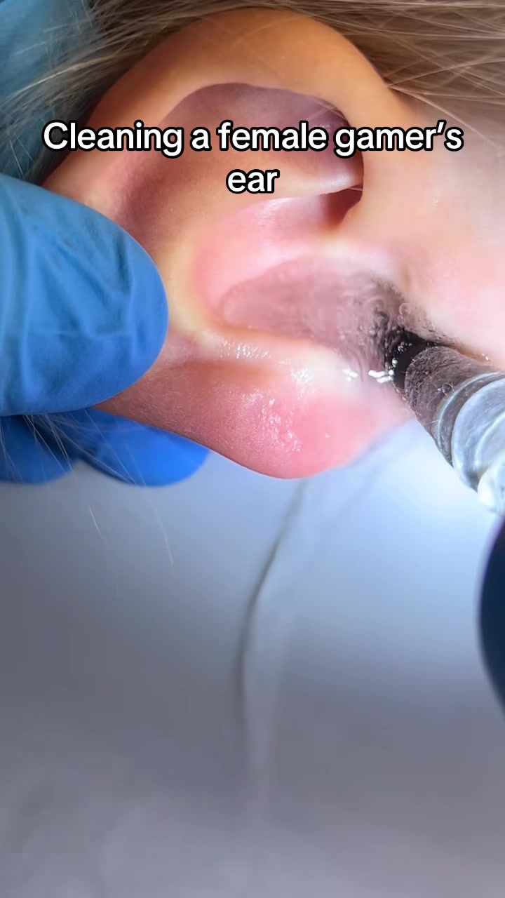 @Satisfying Ear Cleaning Videos