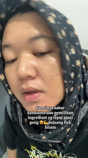@ita_skinjourney