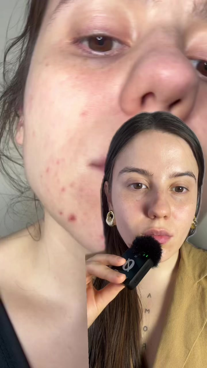 @Belén Estévez