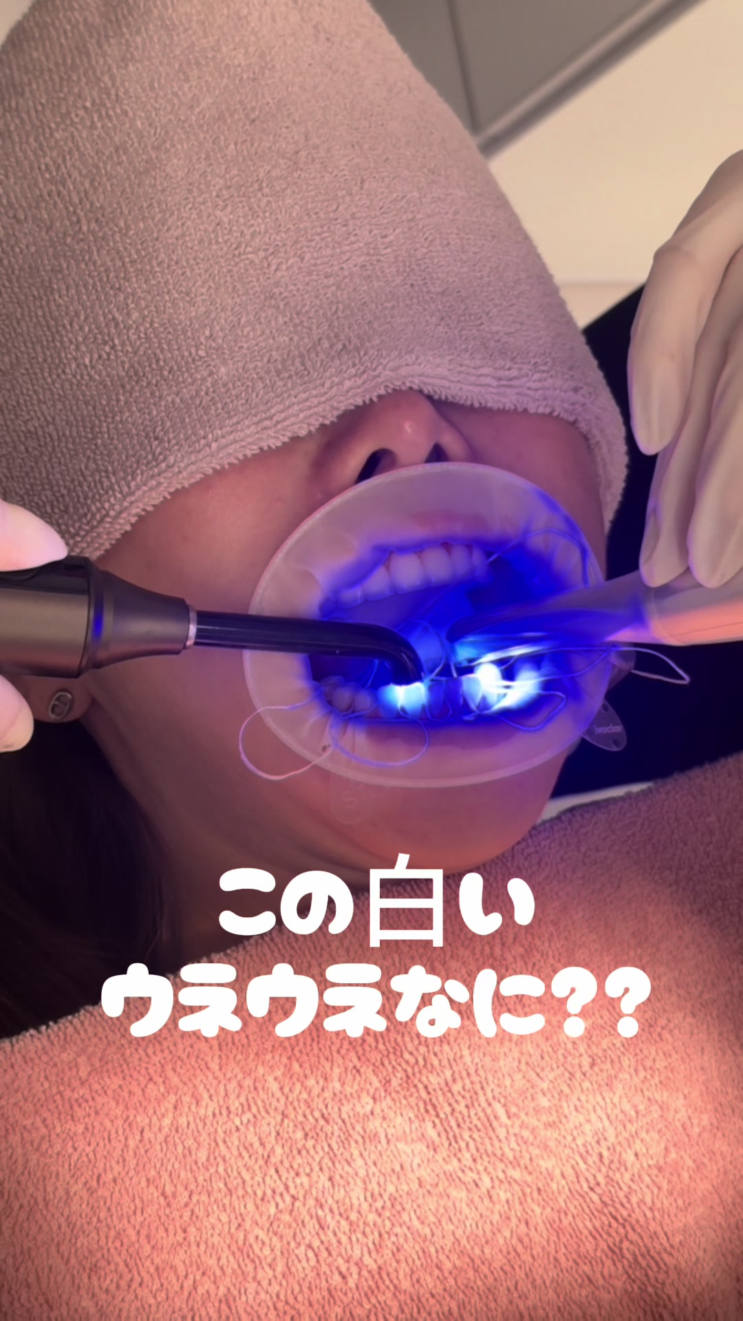 @DENTAL ALIEN
