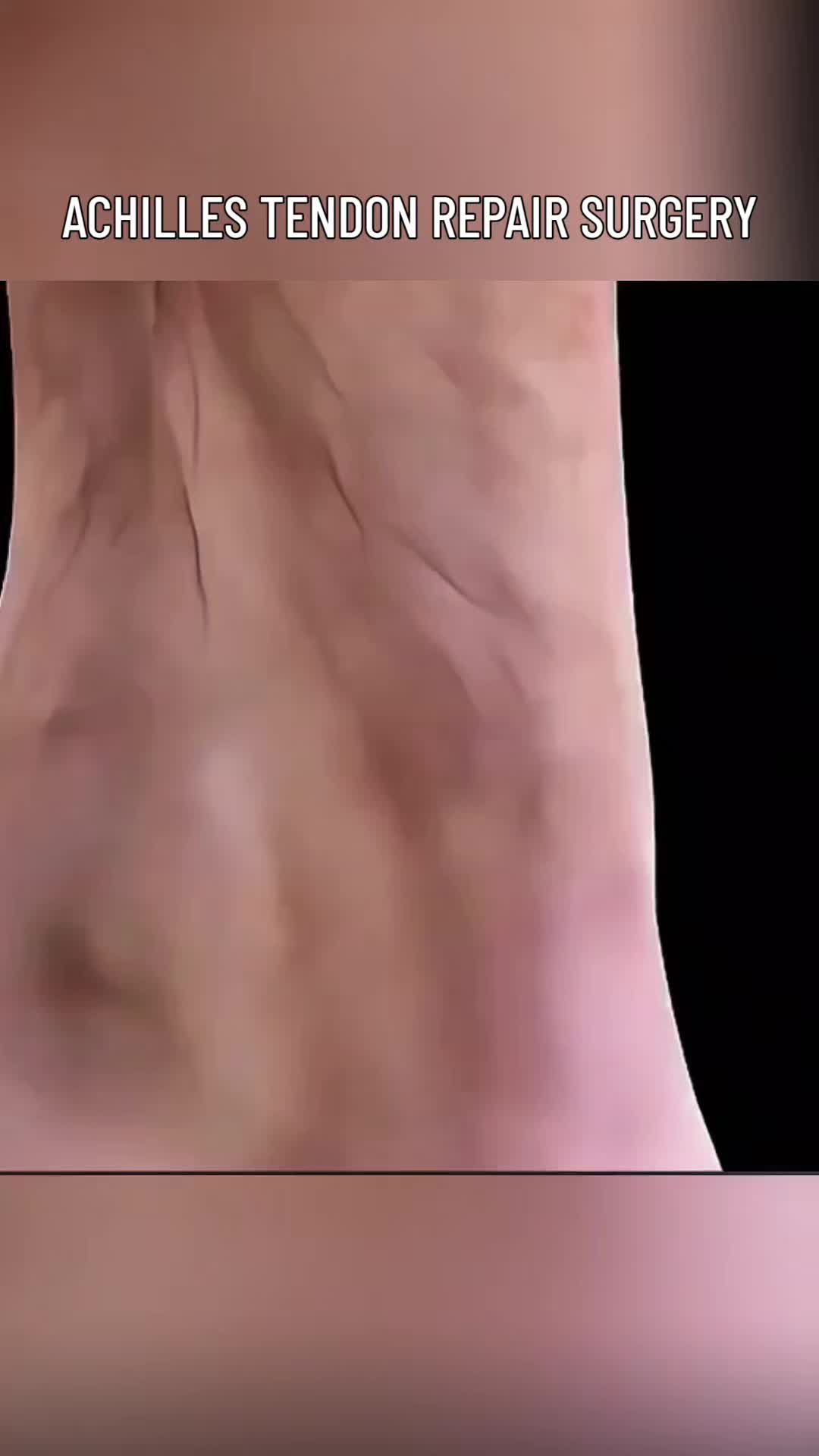 @Secret Body AI