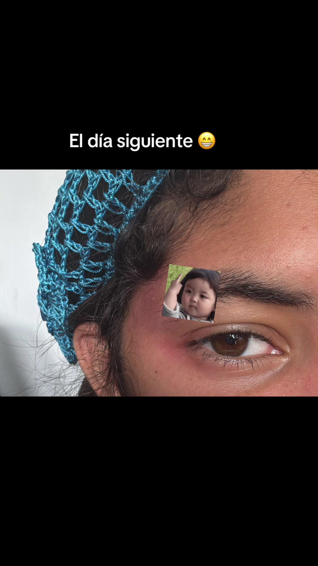 @Chimpi.18