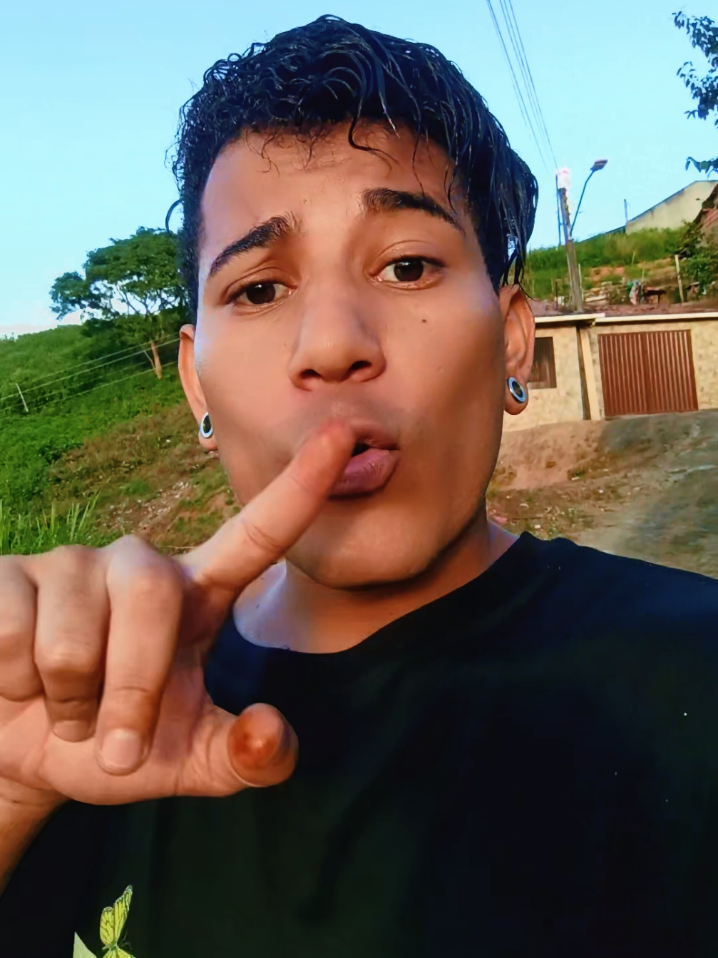@Douglas oficial
