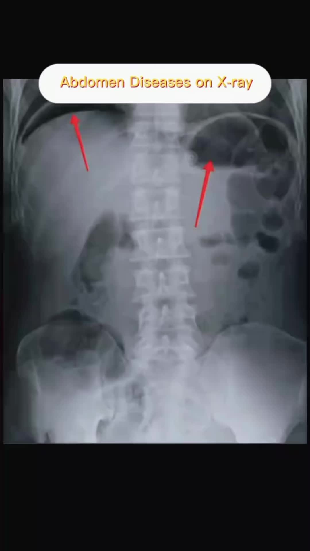@the radiology zone