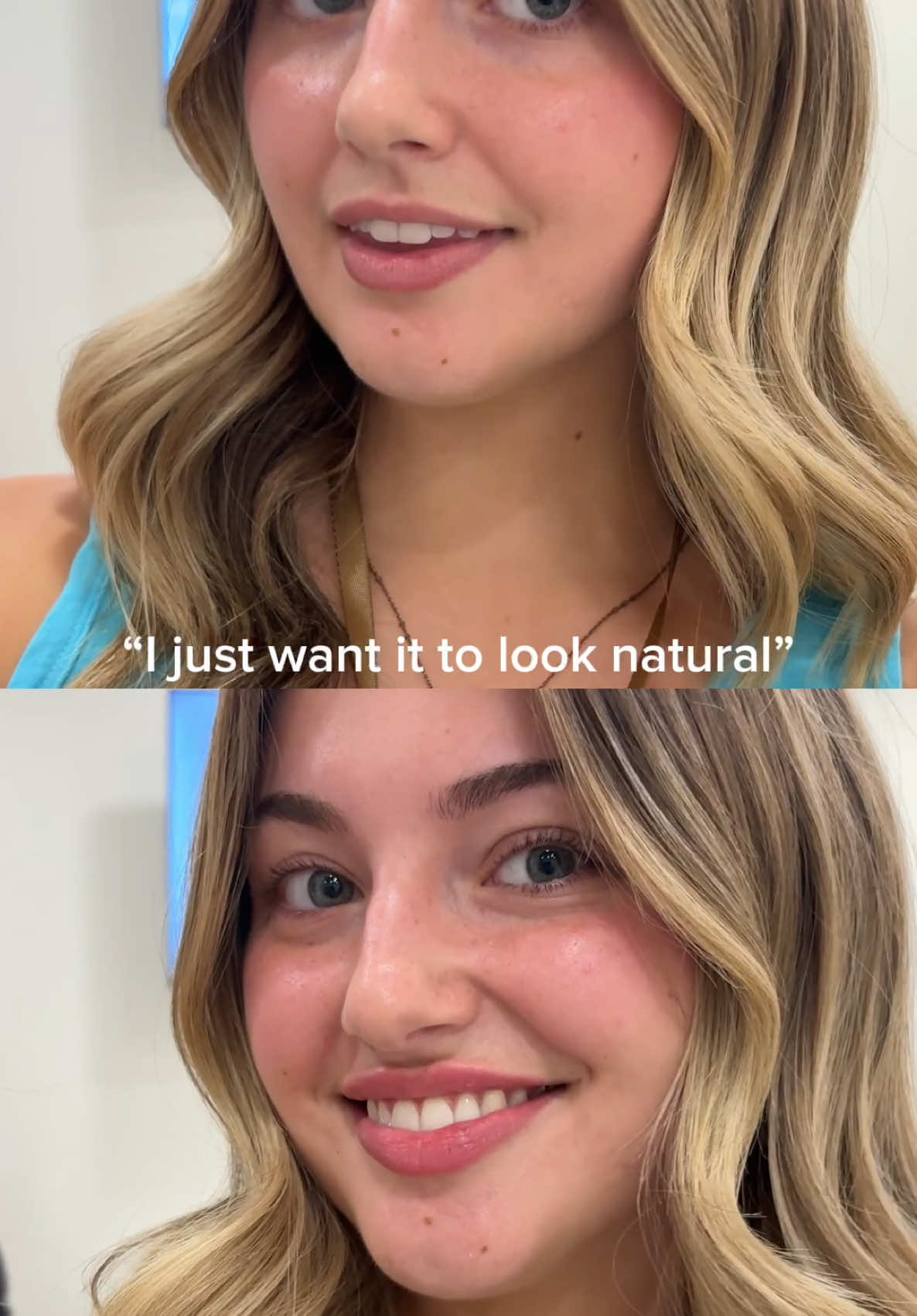 @mercedes