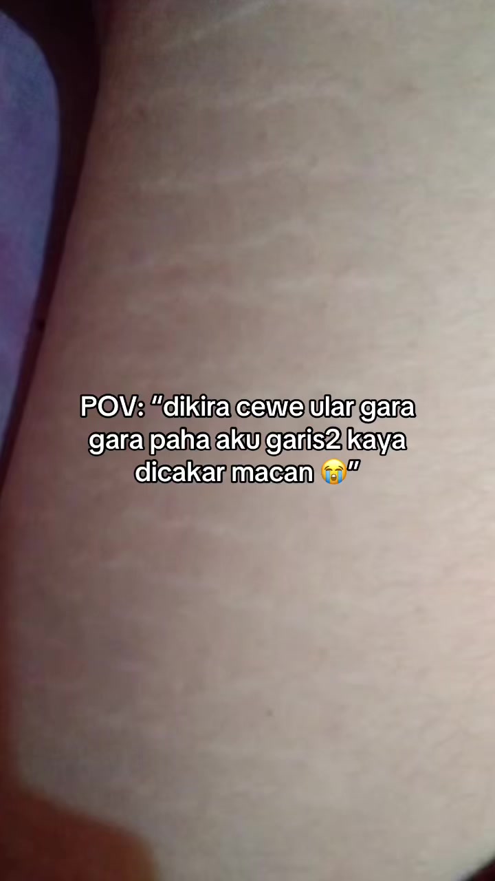 @keicantik🦩