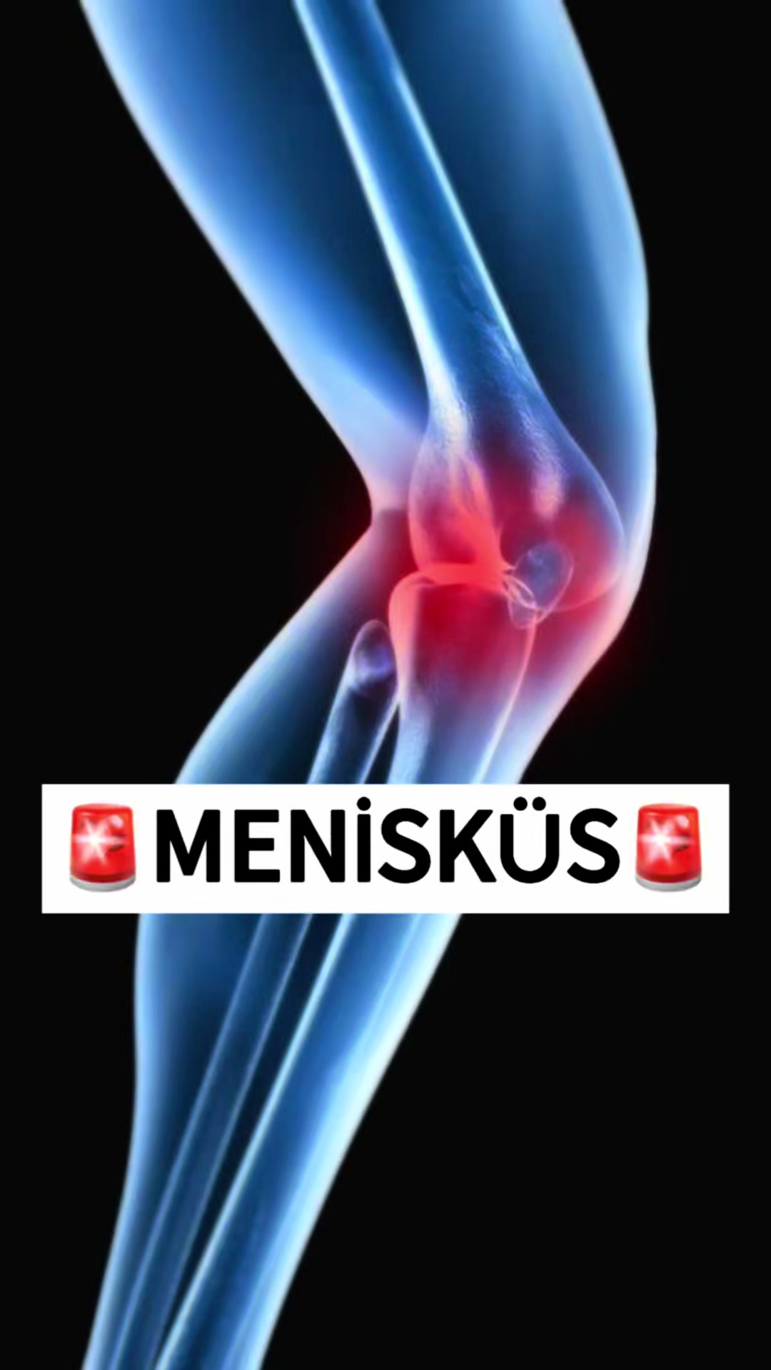 @SPİNE EKS FİZİK TEDAVİ