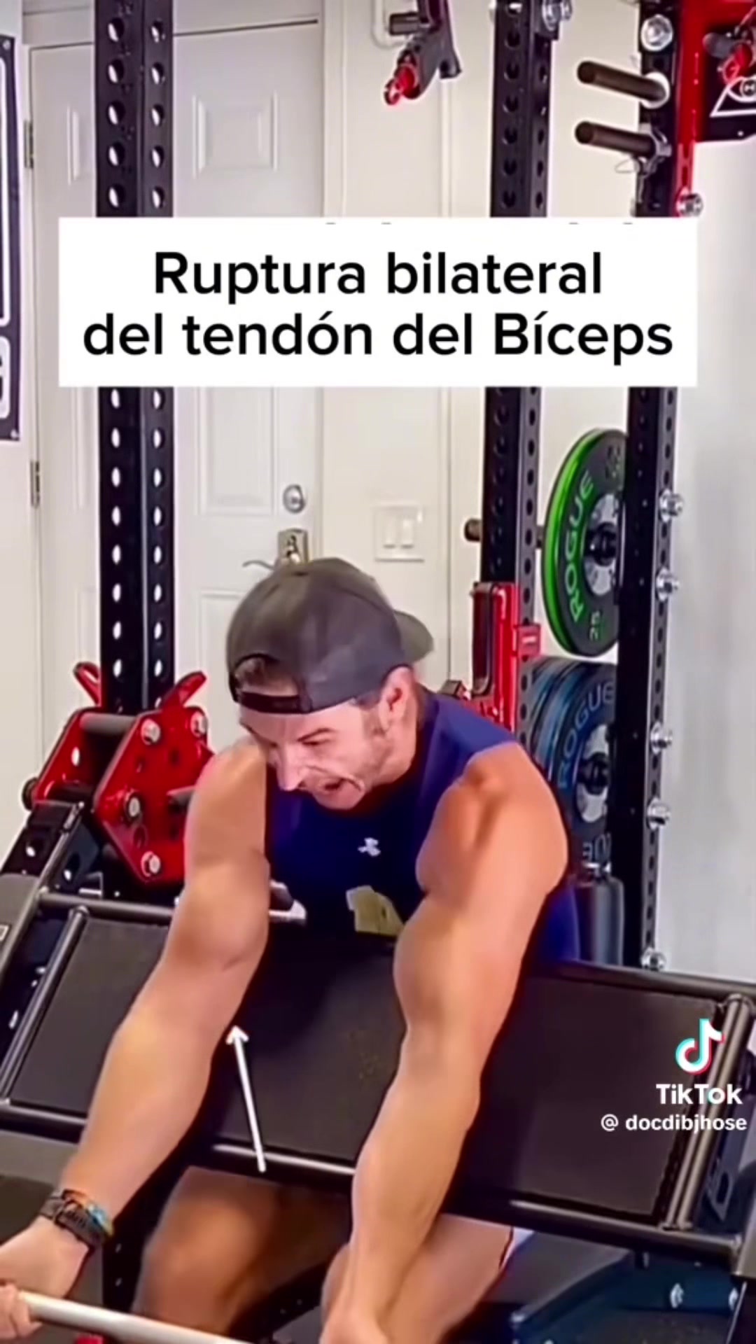 @Jorge Dismorfia