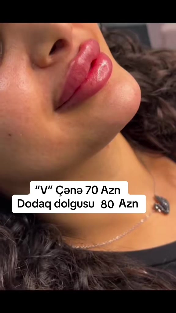 @Kosmetoloq_Gülü_Rajab