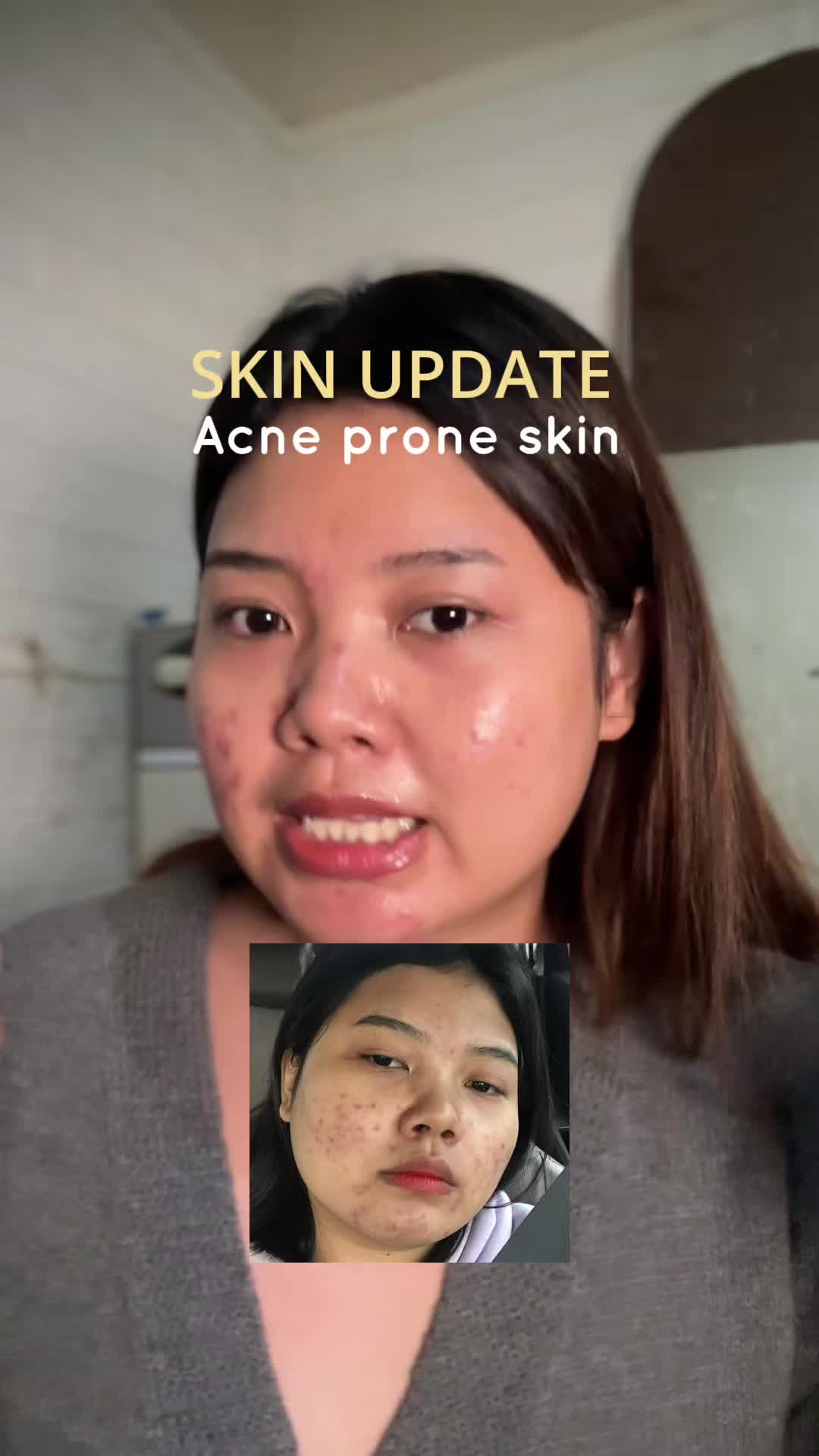 @ichi | glow up journey