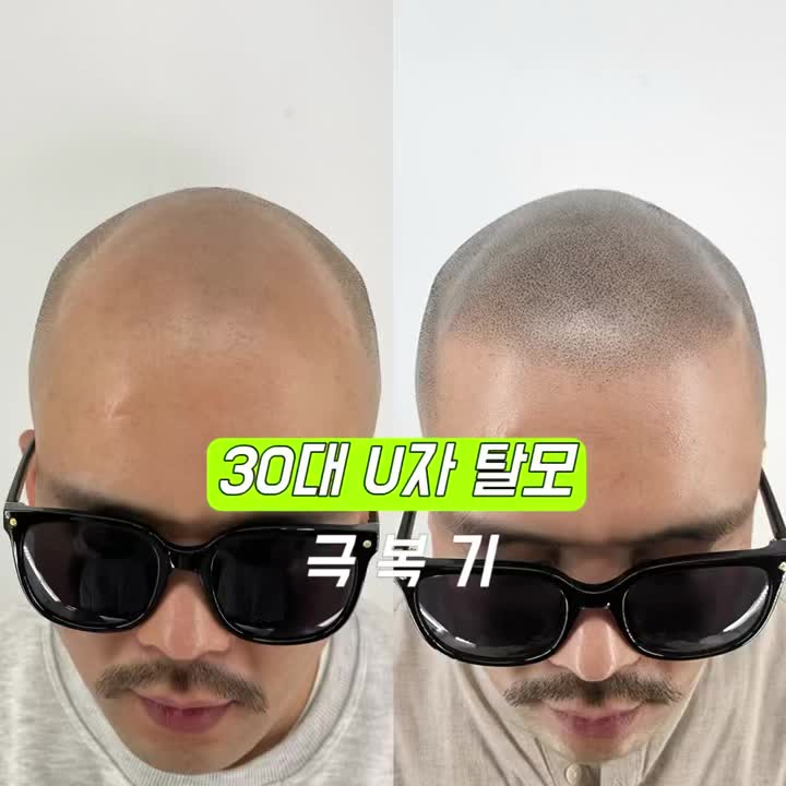 @화성 눈썹문신 잘하는곳(브로우아틱)