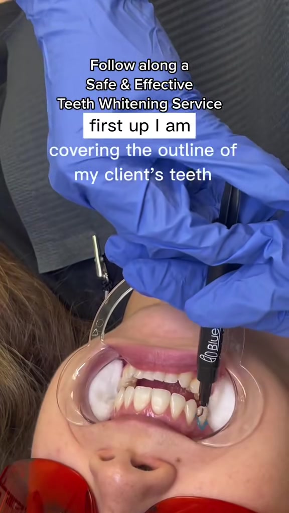 @Diandra | Teeth Whitening Tech