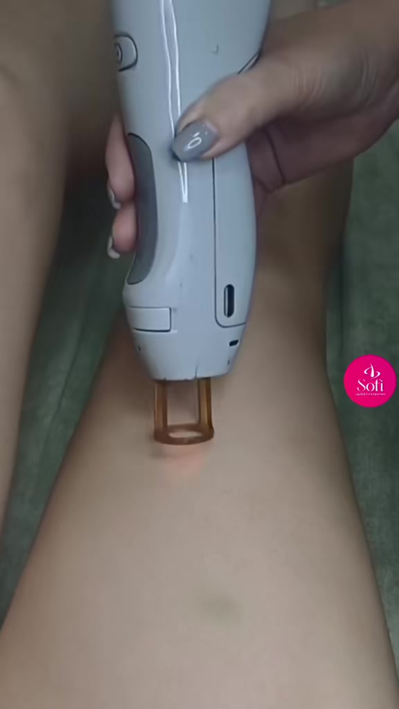 @𝑺𝒐𝒇𝒊 𝑳𝒂𝒛𝒆𝒓✨️