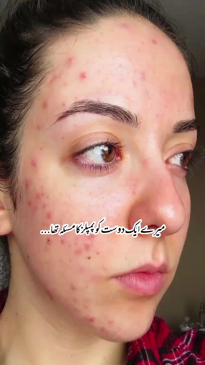 @✨𝗦𝗸𝗶𝗻𝗖𝗮𝗿𝗲_𝗤𝘂𝗲𝗲𝗻✨