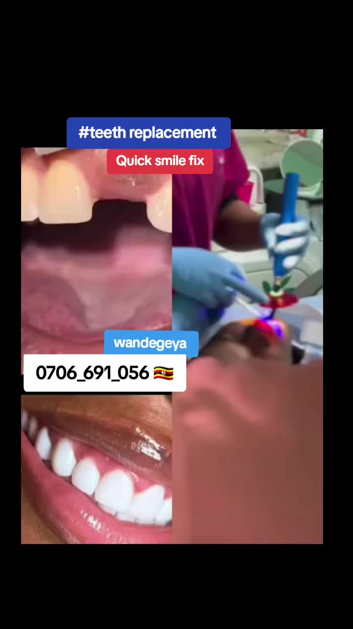 @Dental studio.🦷.Kampala