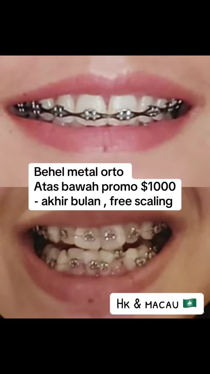 @mbak-Paijem
