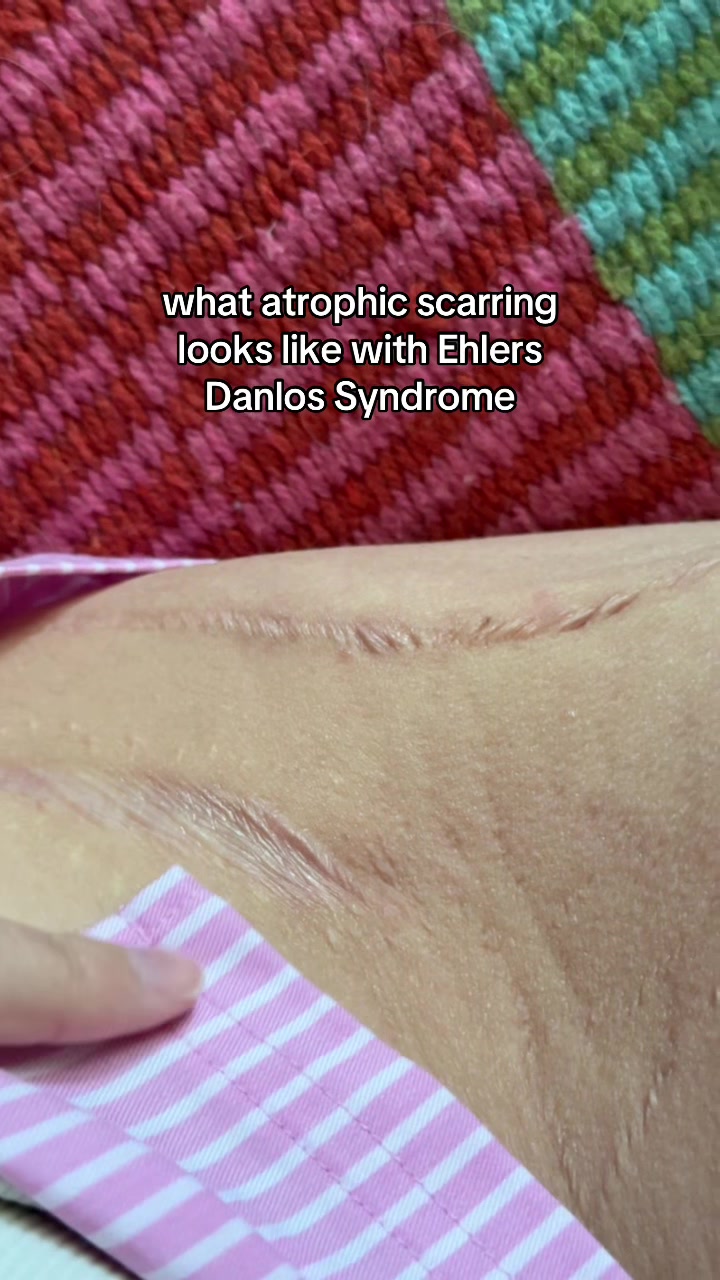 @distaaybled