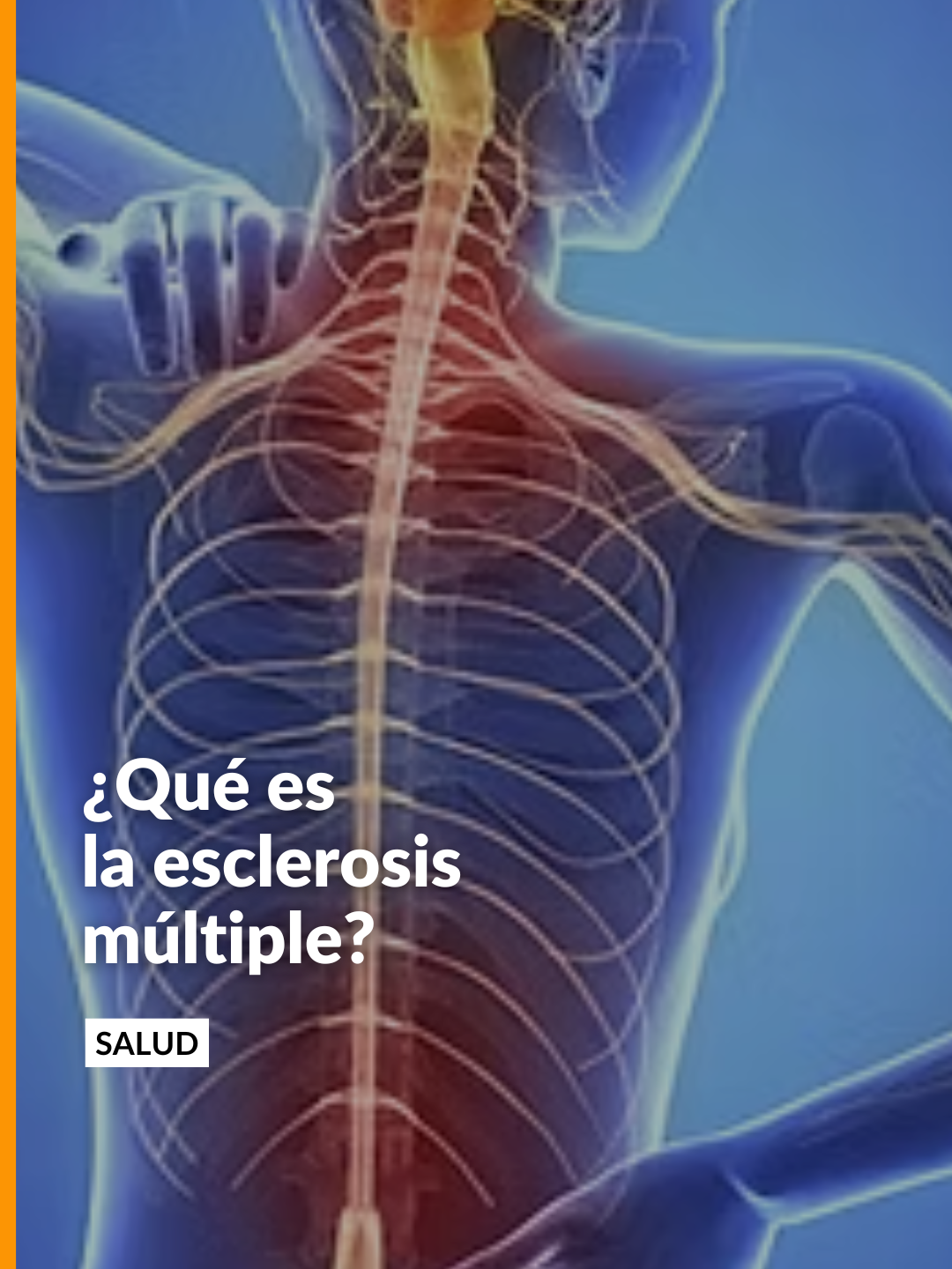 @Noticias Caracol