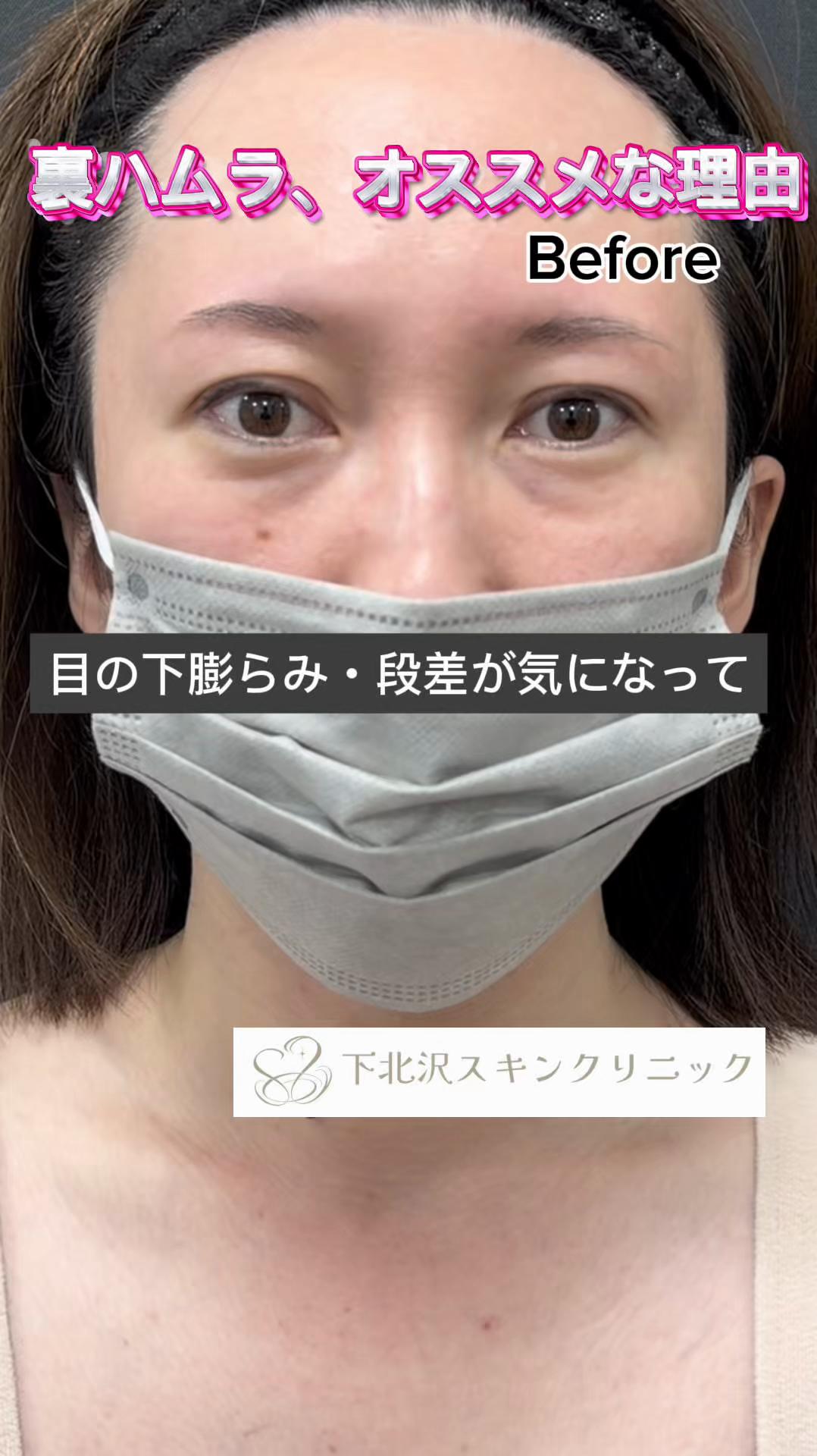 @下北沢スキンクリニック院長・こころの美容外科医・保坂宗孝