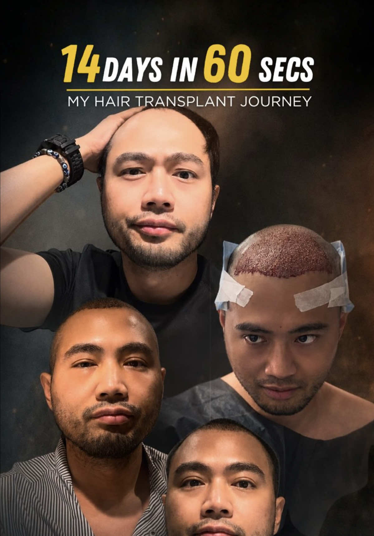 @Jelo Mariano
