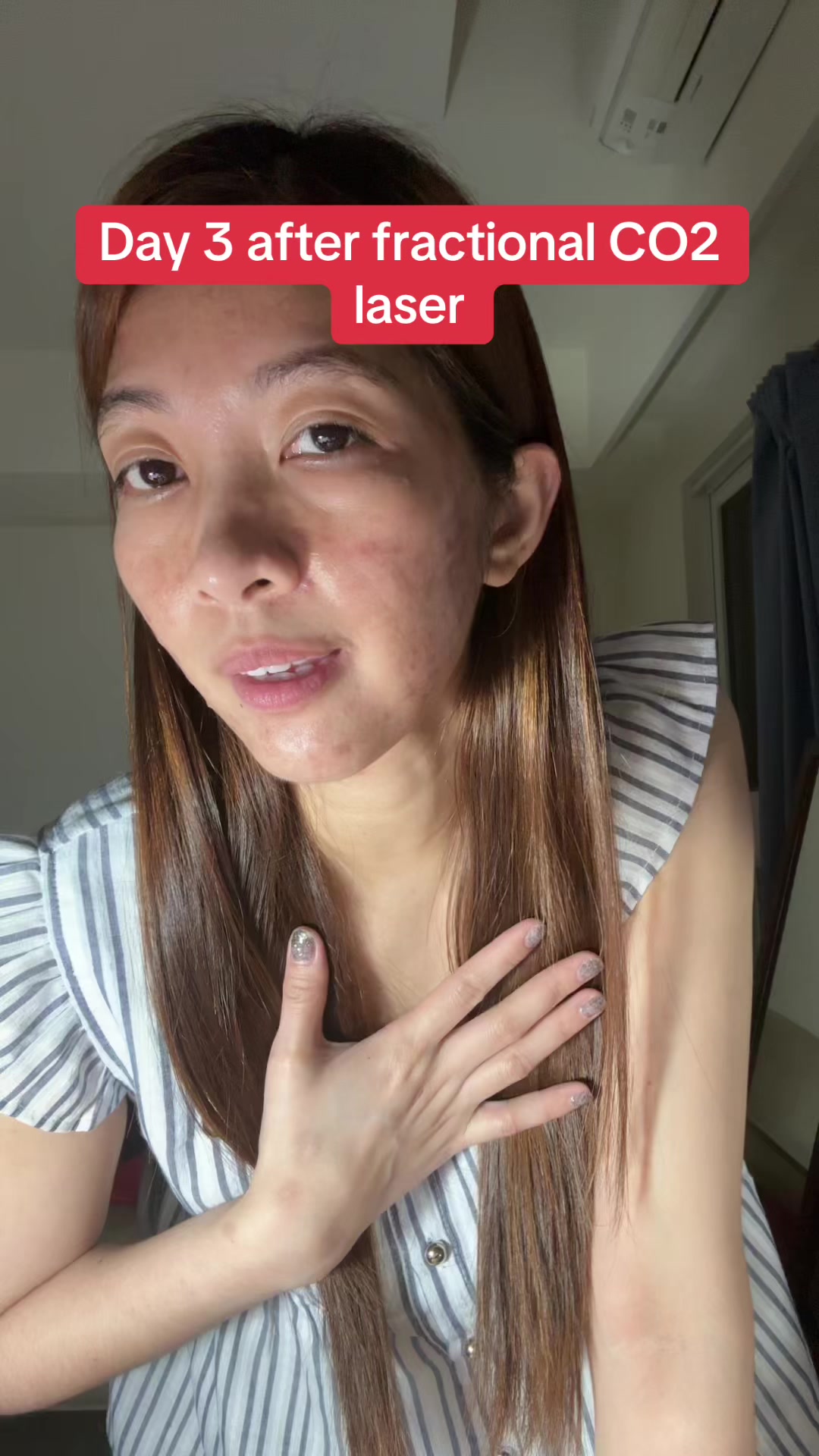 @Love🇵🇭🇹🇼