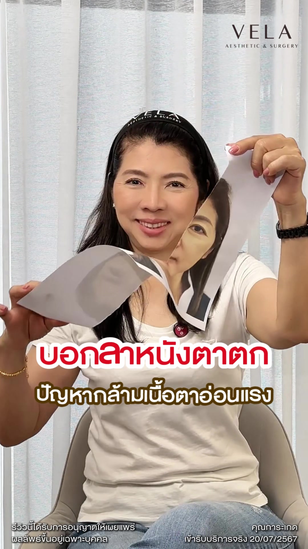 @เวลาคลินิก ตาสองชั้น ถุงใต้ตา