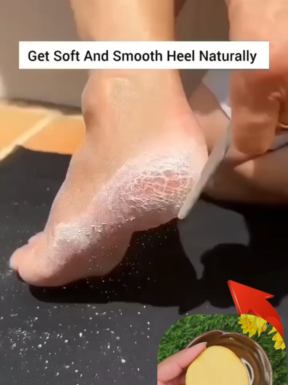 @Natural Beauty Remedy