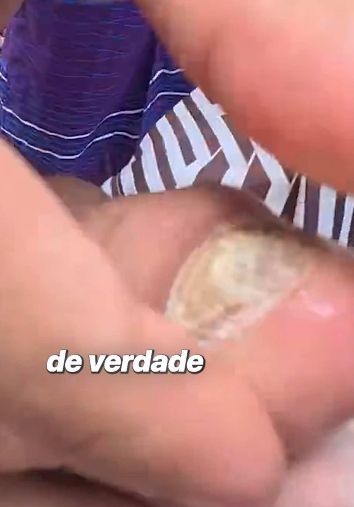 @Calebe Dias