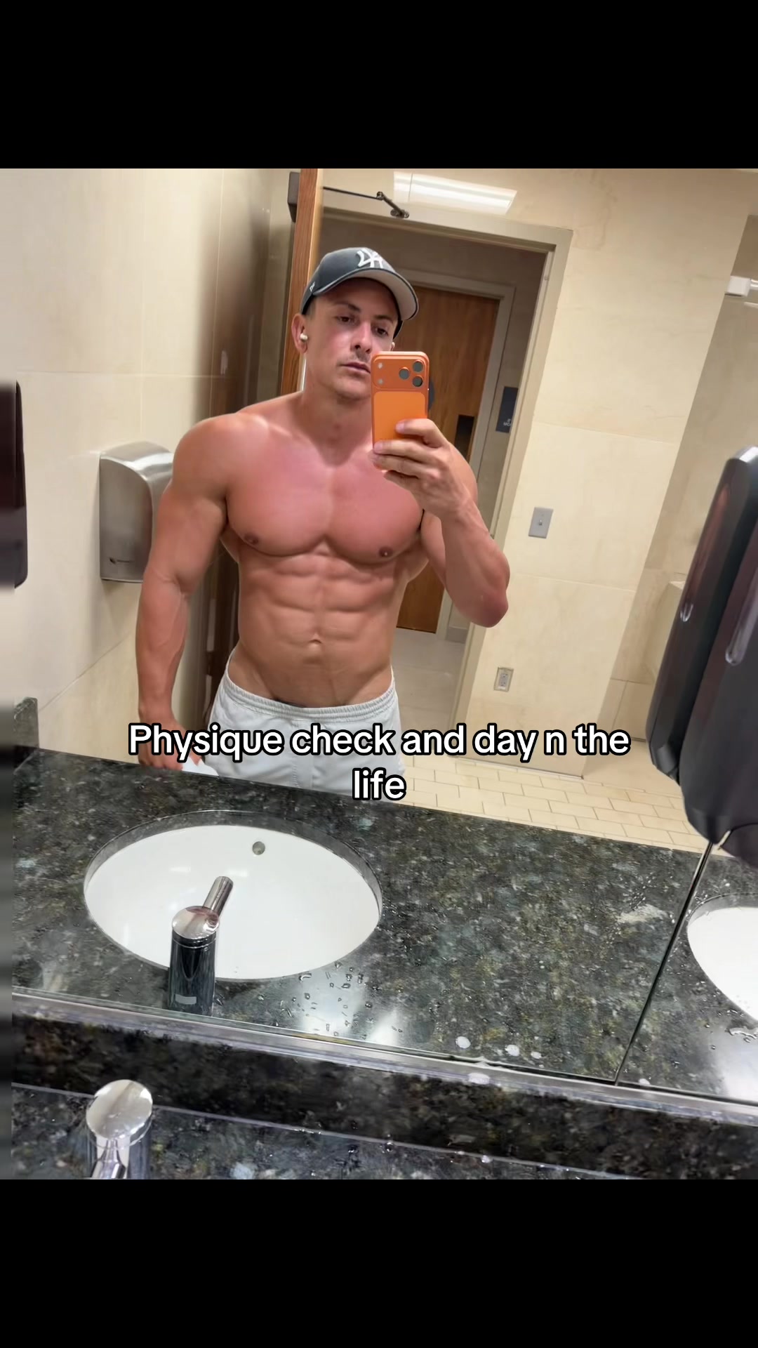 @Anthony Pacella